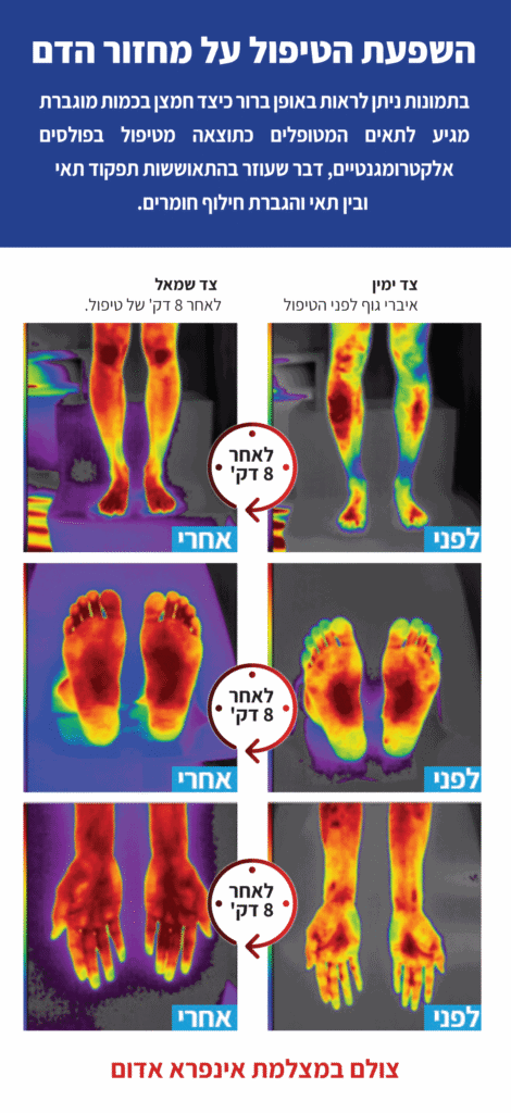 תרשים אזורי טיפול במגנטותרפיה על גוף האדם